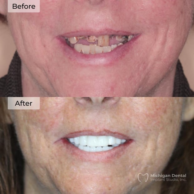 Images Michigan Dental Implant Studio