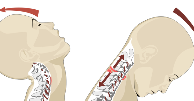 Images Charlotte Auto Accident Injury Chiropractic