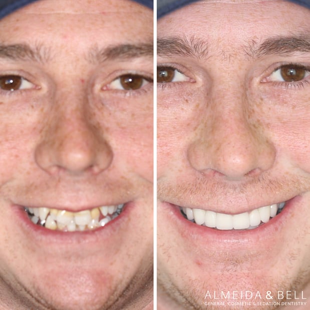 Images Almeida & Bell Dental Lone Tree - General, Cosmetic, and Implant Dentistry