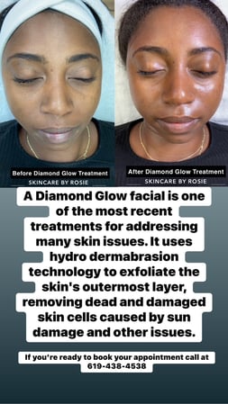 Images Skincare by Rosie