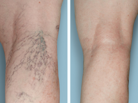Images Metro Vein Centers | Clear Lake