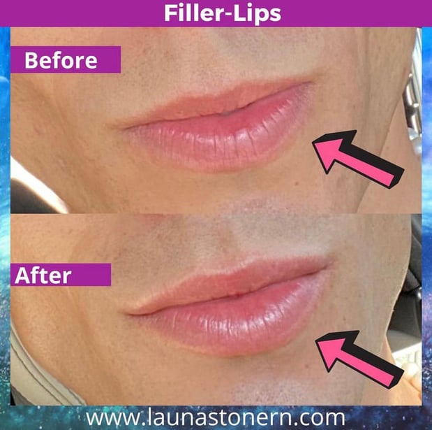 Images Launa Stone, R.N.