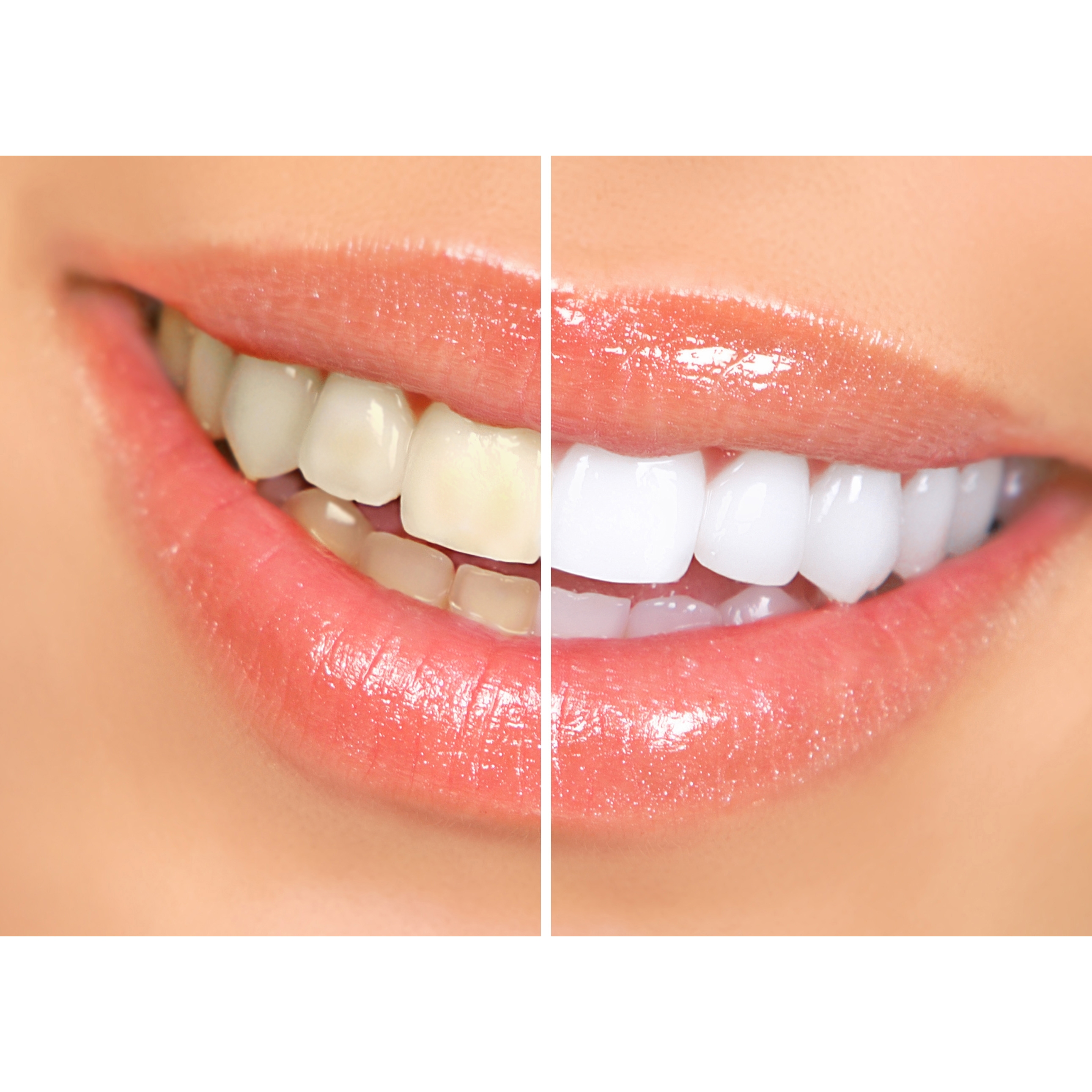 Jolie Blanc Teeth Whitening Logo