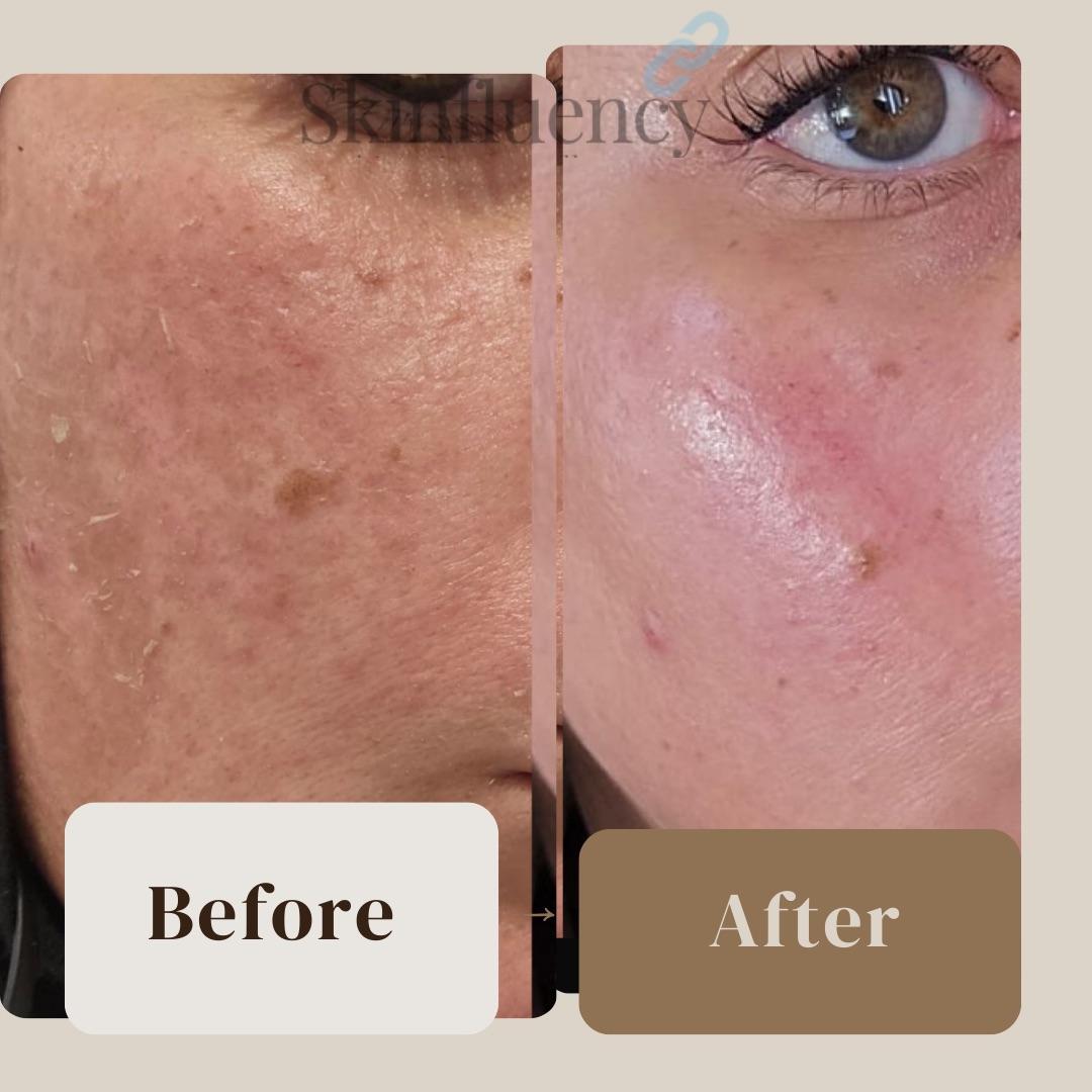 Images Luminous Skin