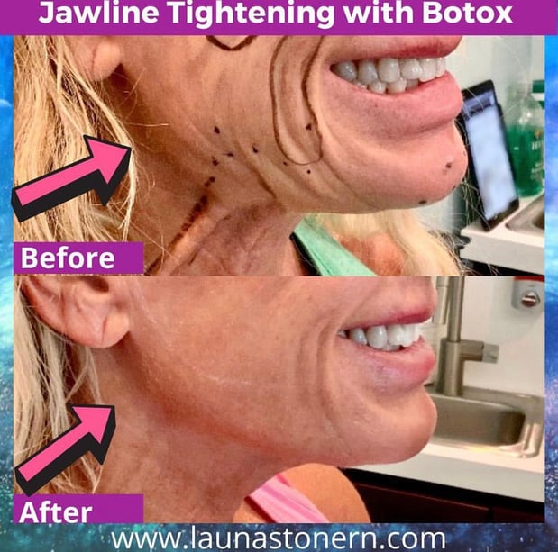 Images Launa Stone, R.N.