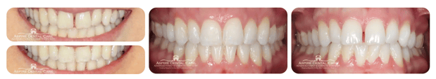 Images Aspire Dental Care PLLC
