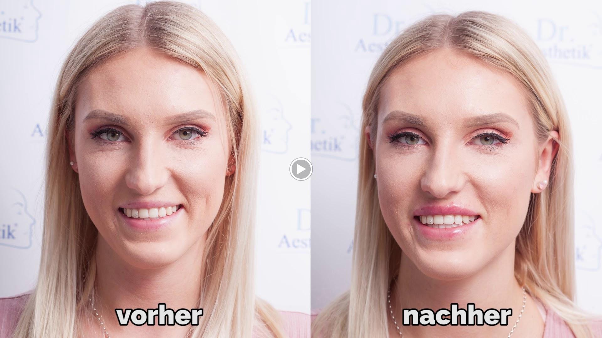 Bild 1 Dr. Aesthetik Stuttgart- Institut für ästhetische Behandlungen (Dr. Tobias Böpple) in Stuttgart