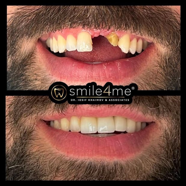 Images smile4me Dental Care - Astoria, Queens
