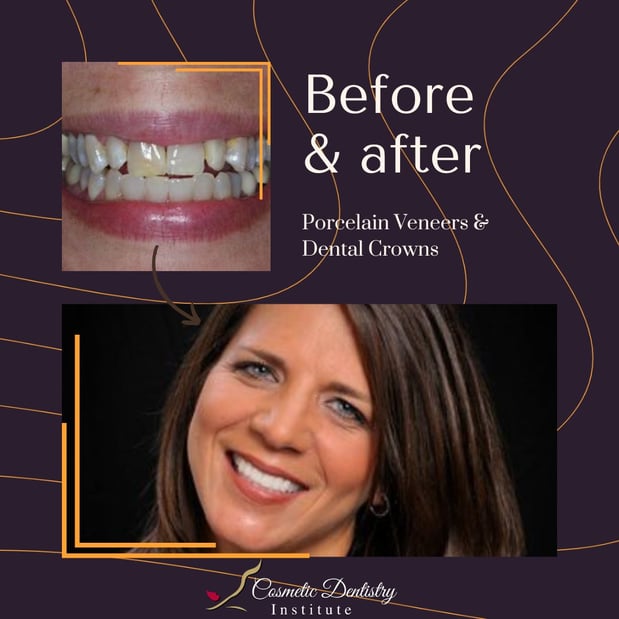 Images Cosmetic Dentistry Institute