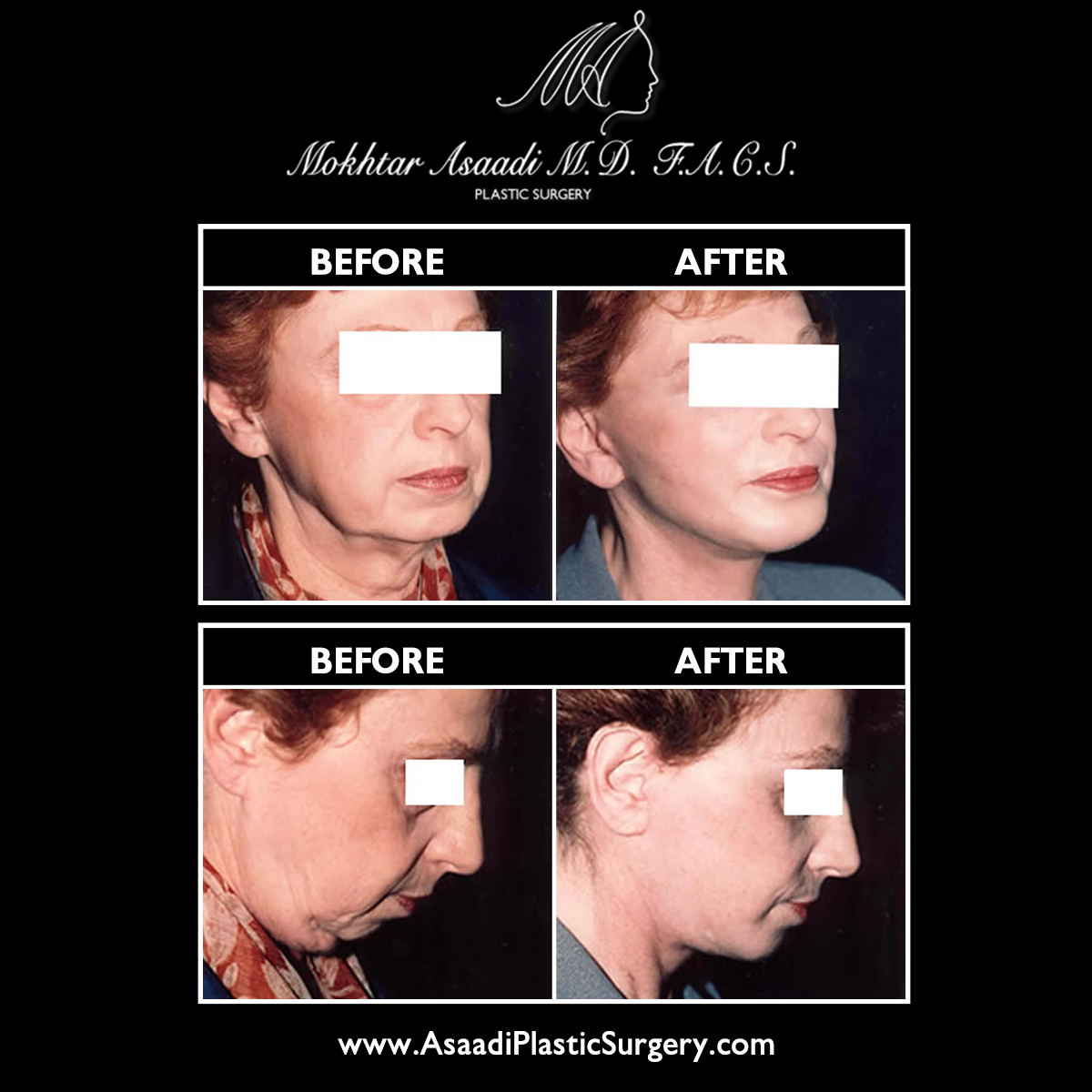 Asaadi Plastic Surgery Image