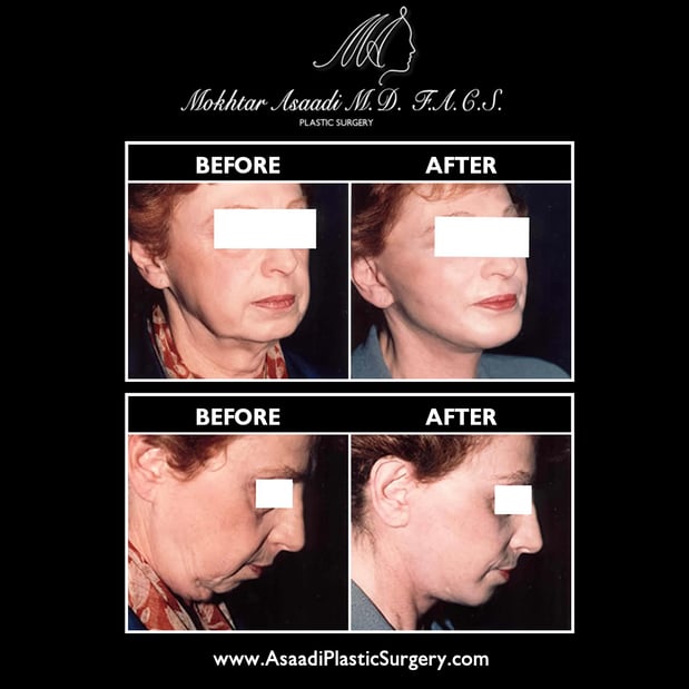 Images Asaadi Plastic Surgery