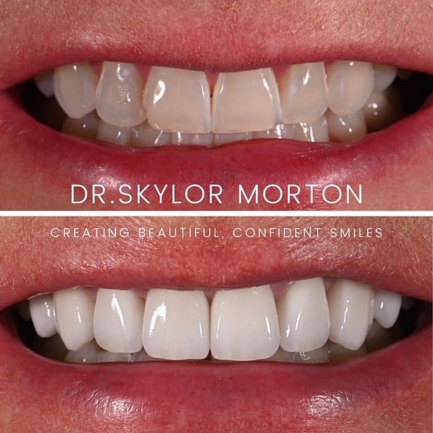 Images Nashville Wisdom Teeth and Implant Solutions