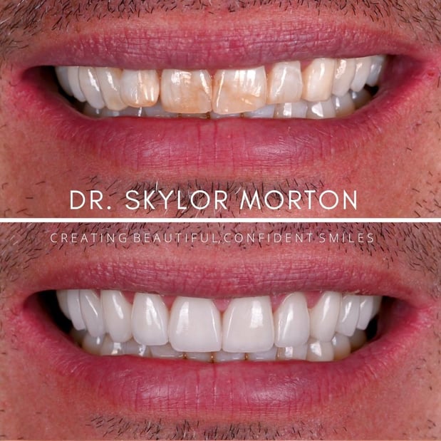 Images Nashville Wisdom Teeth and Implant Solutions