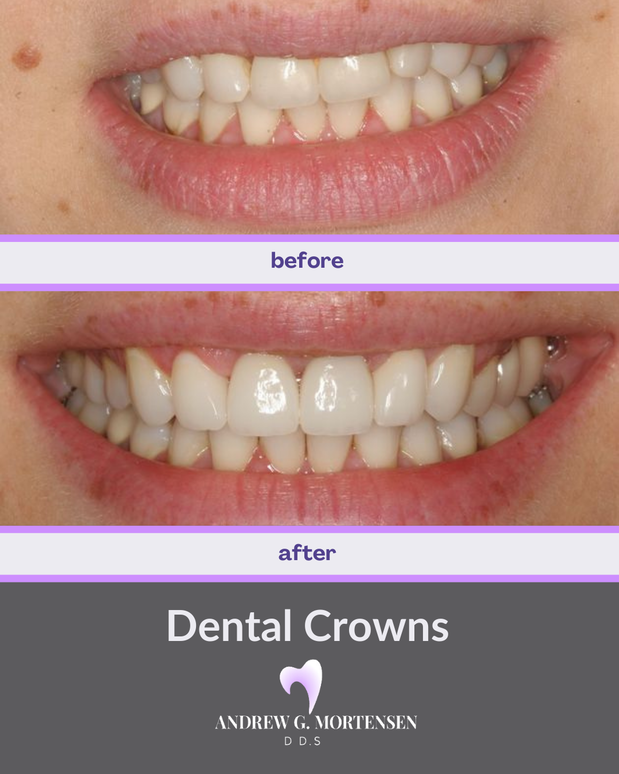 Images Andrew G. Mortensen, DDS