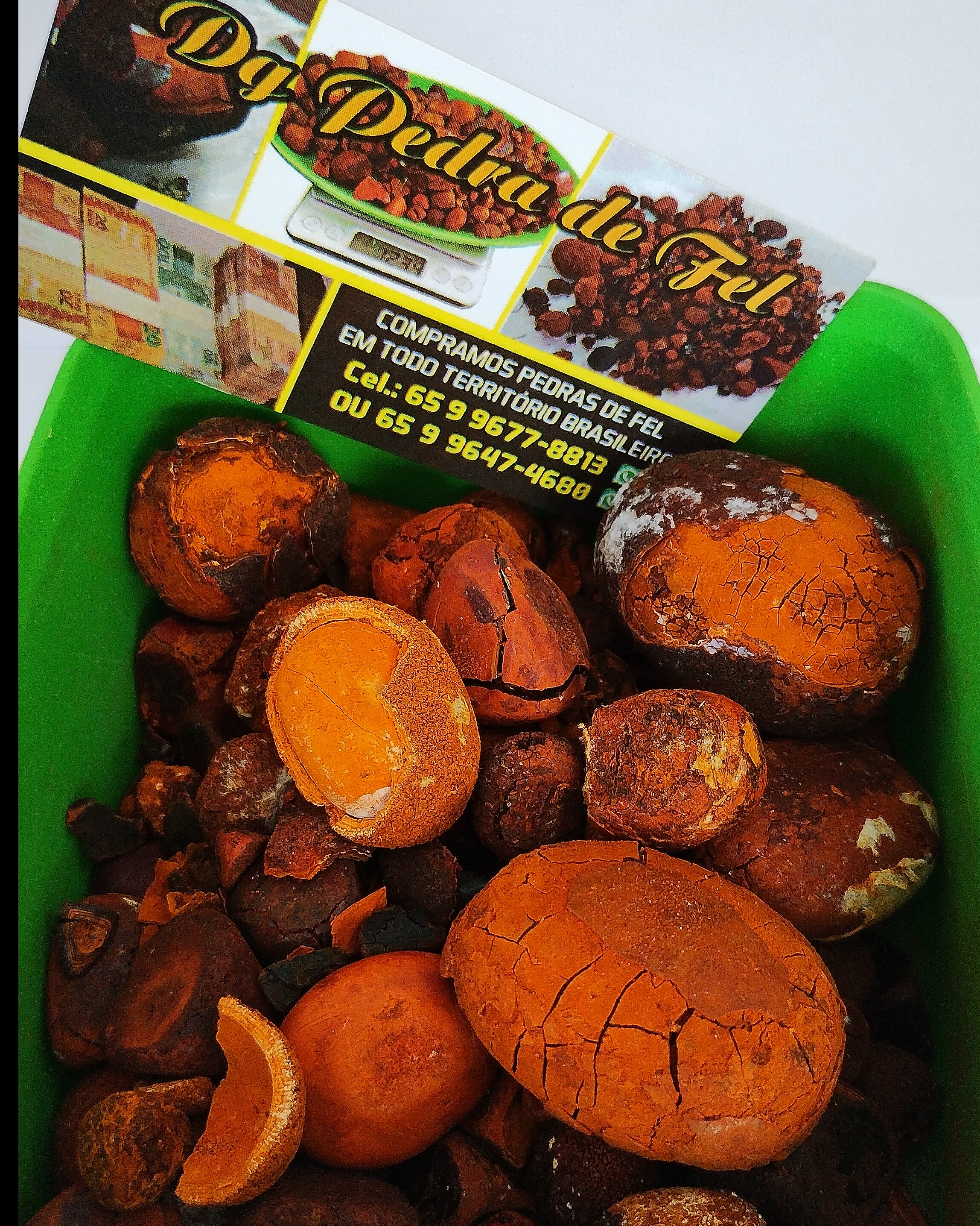 Images Dg pedras de fel bovinos