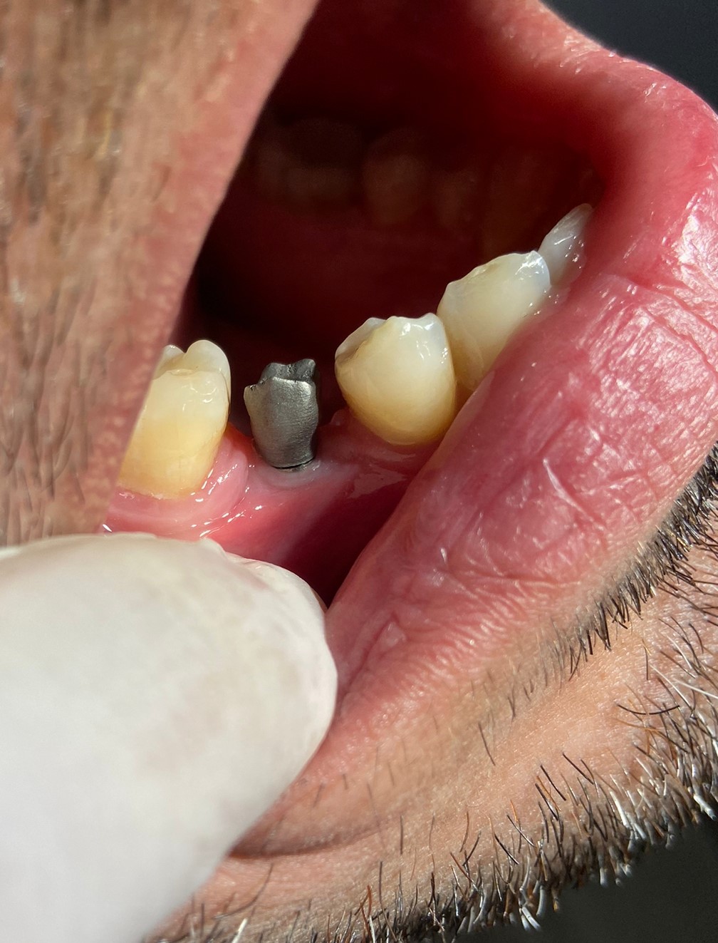 Images Dentalex