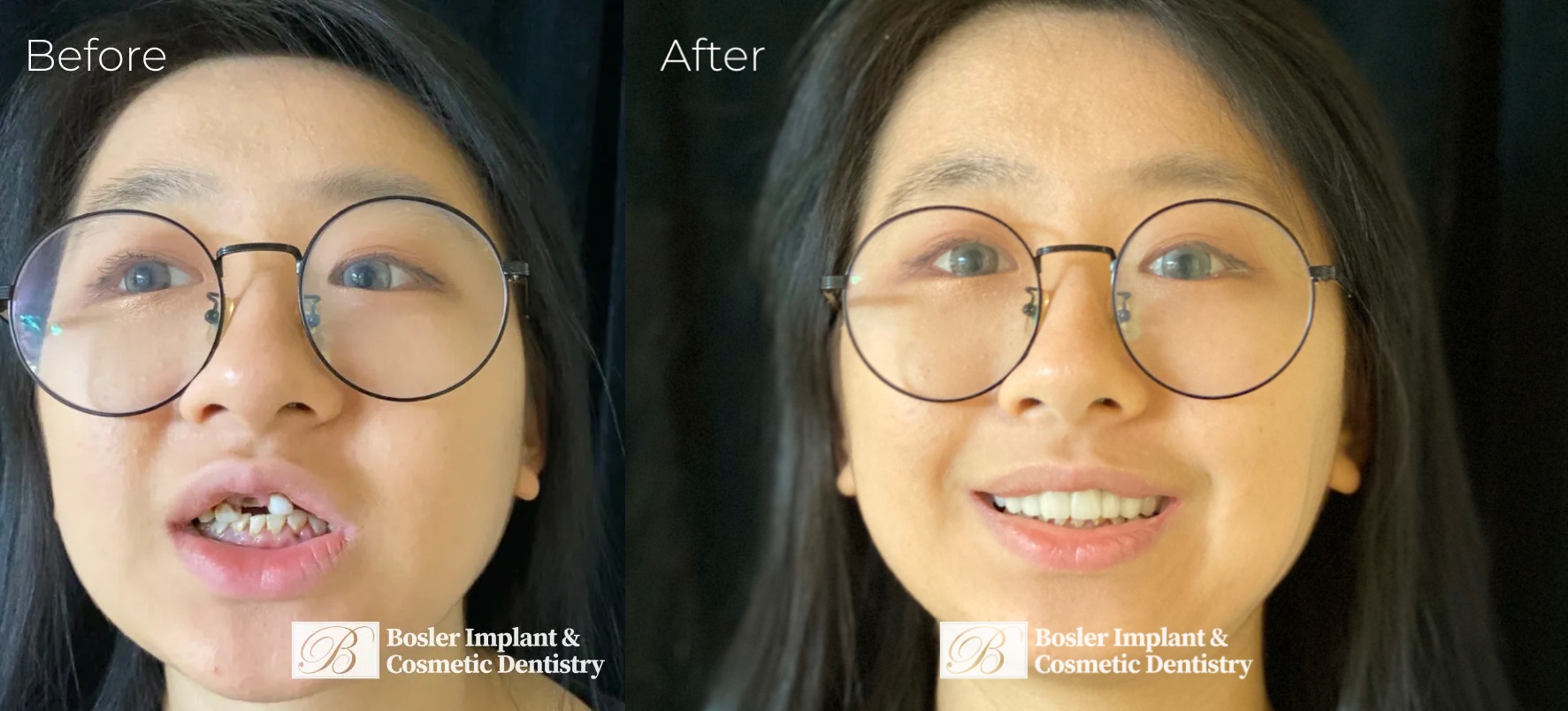 Bosler Implant & Cosmetic Dentistry Image