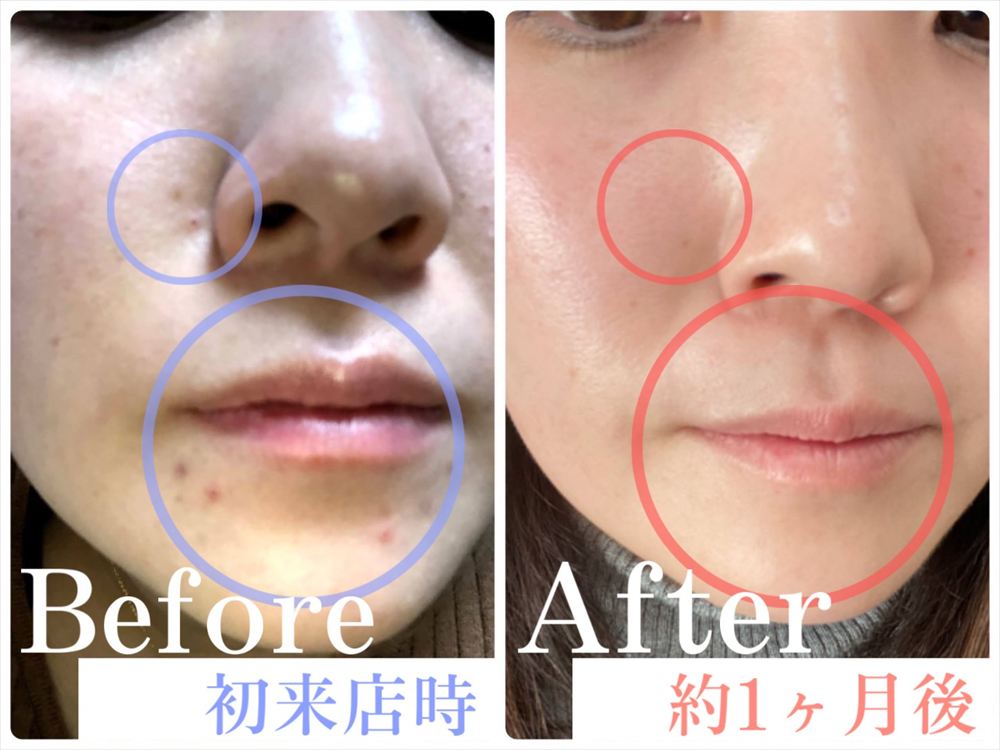 Images 肌質改善サロンサルヴァトーレ長崎