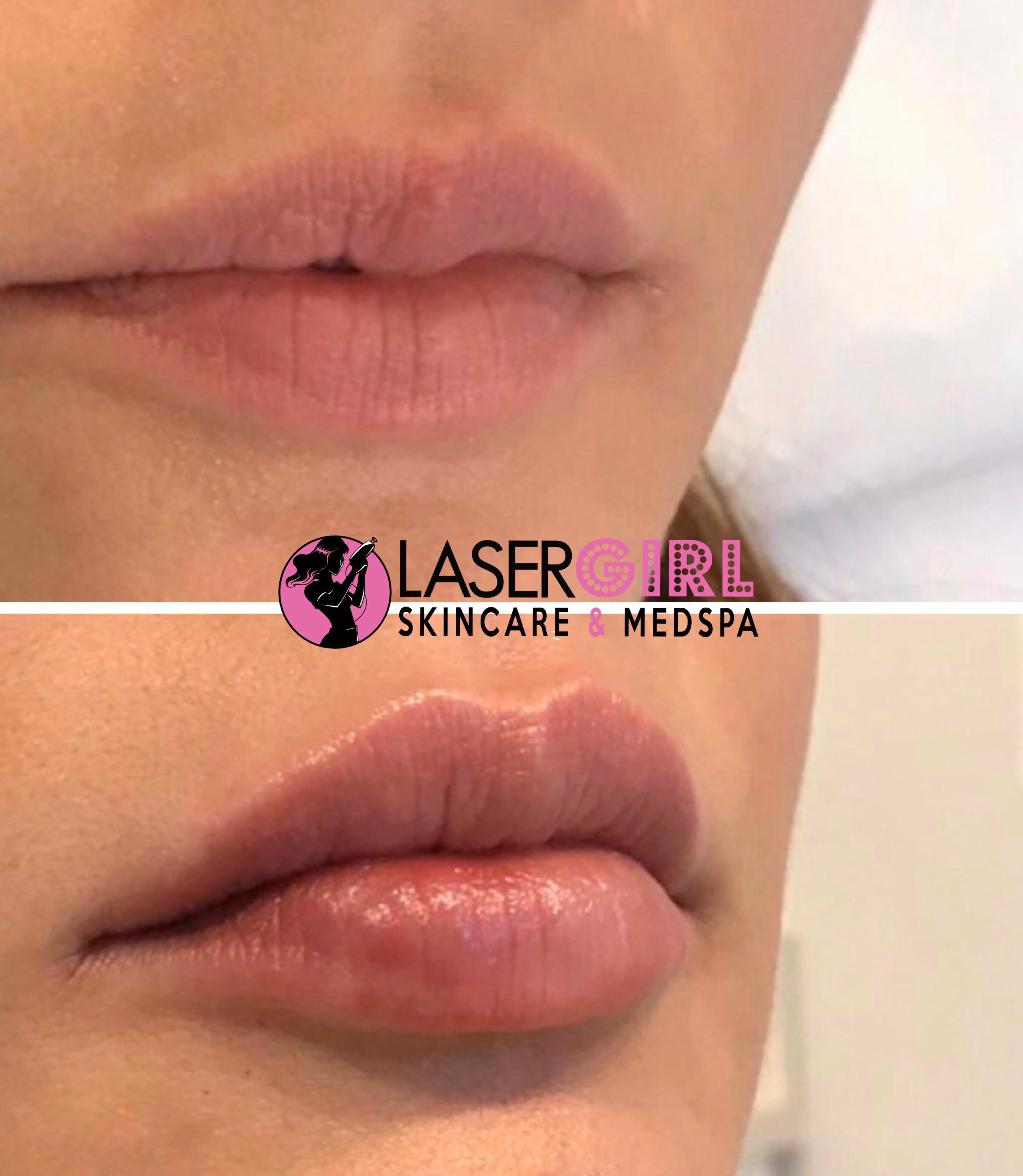 Laser Girl SkinCare & Med Spa Photo