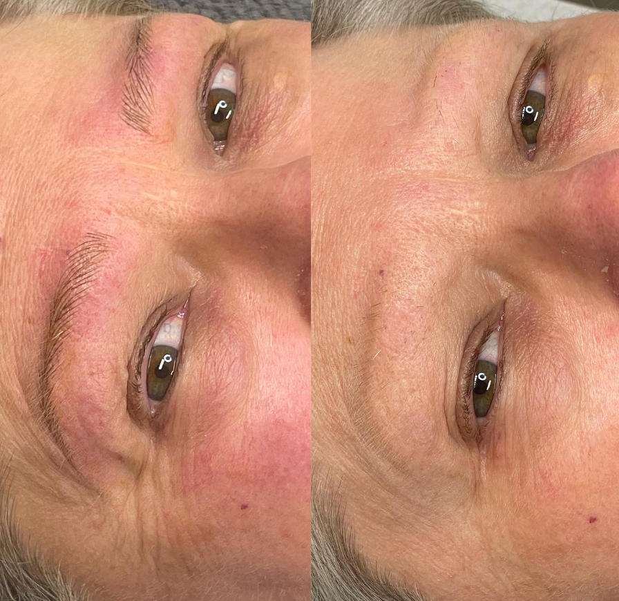 Images Clinique d'Esthétique Leila - Hydrafacial, Microblading, Épilation Laser Sainte-Foy