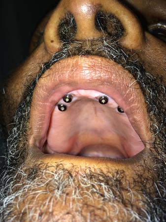 Images Oluwole Ajagbe, D.D.S., M.S