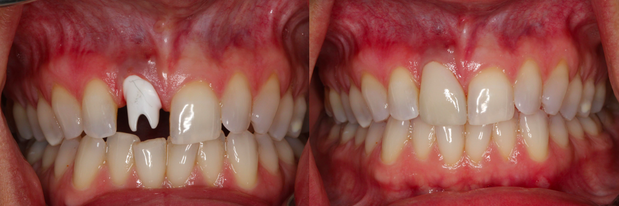 Images Cosmetic and Implant Dentistry of Connecticut