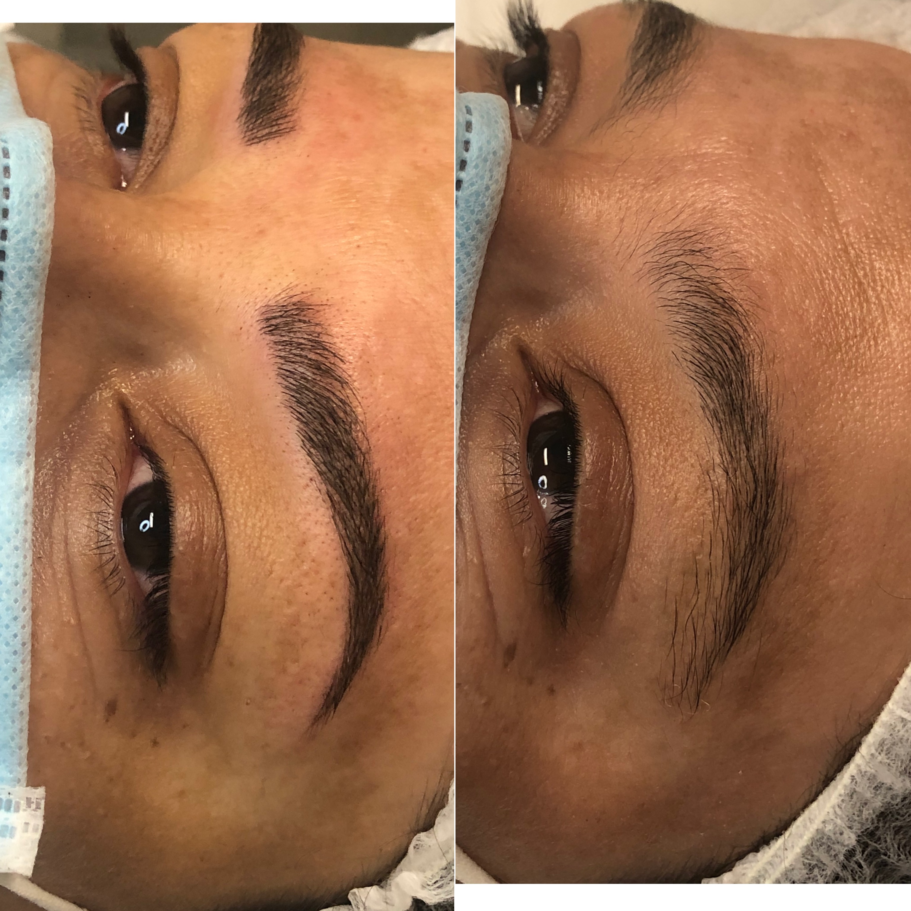 Images Clinique d'Esthétique Leila - Hydrafacial, Microblading, Épilation Laser Sainte-Foy