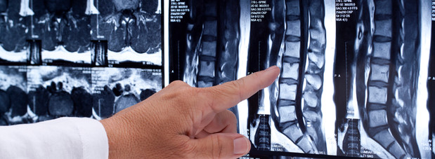 Images Long Island Spine Rehabilitation Medicine