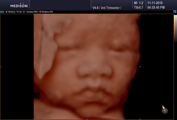 Images Heavenly 3D 4D Ultrasounds