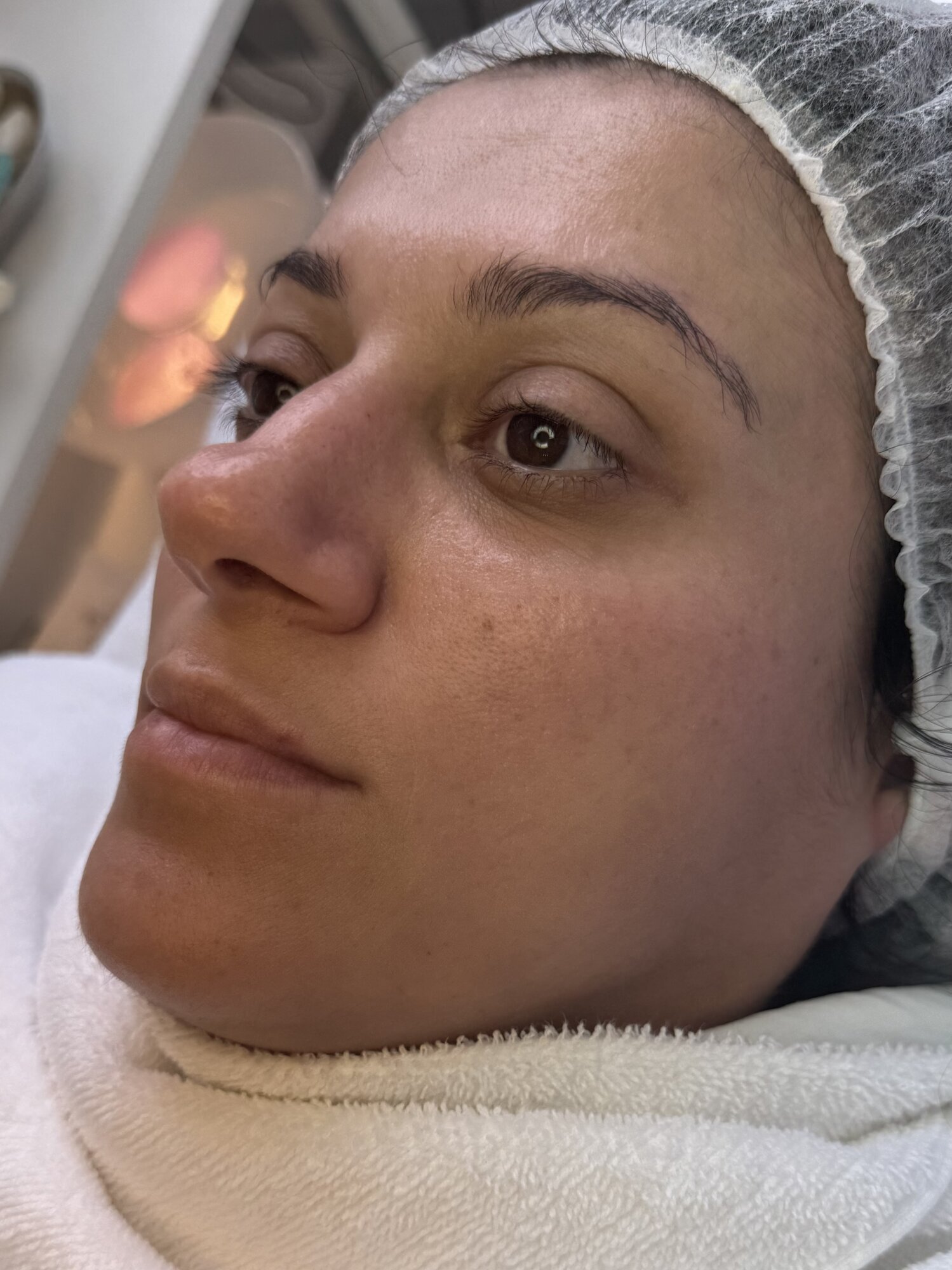 SKINNOVA Face & Body - GALLERY