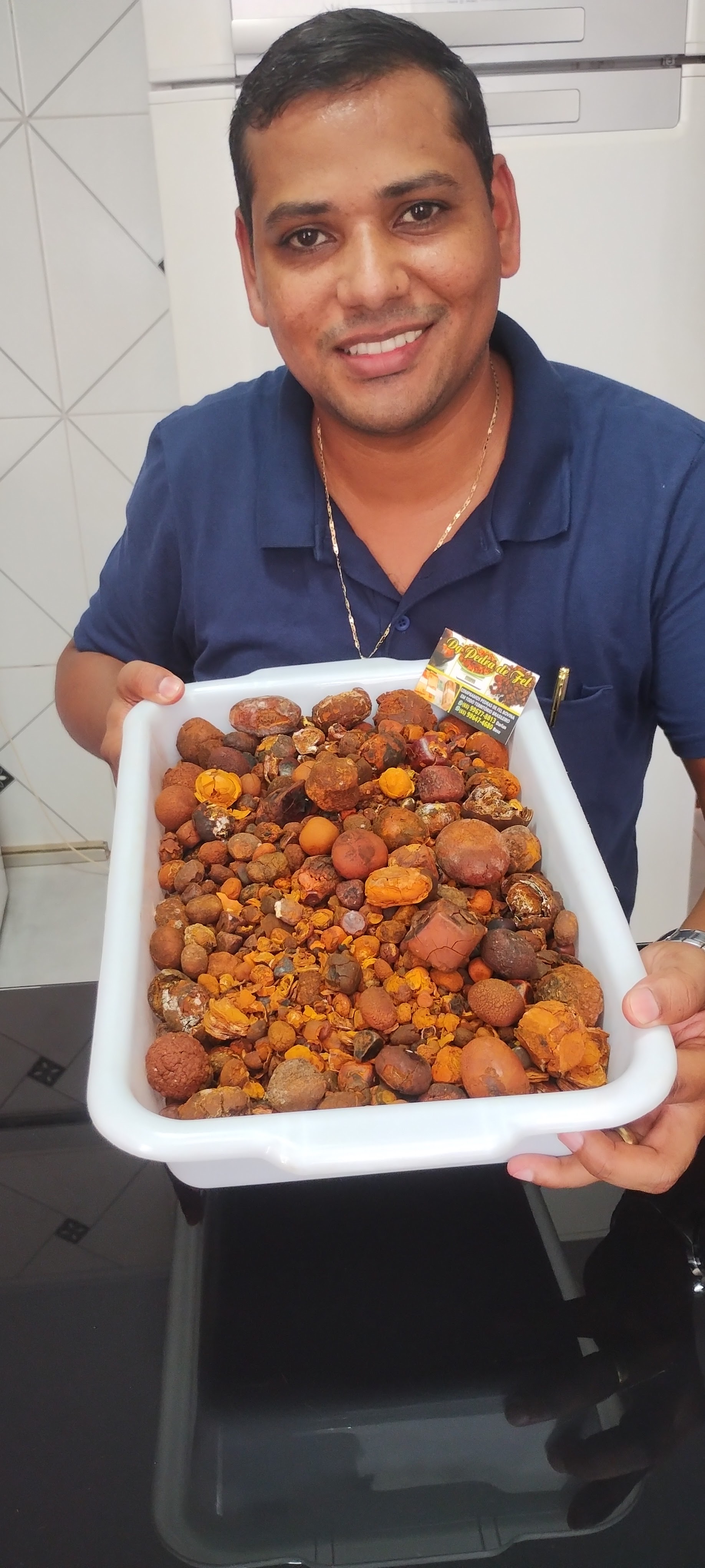 Images Dg pedras de fel bovinos