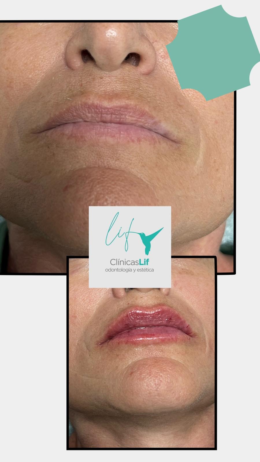 Images Clinicas Lif