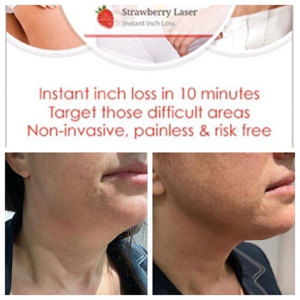 Images Renew Body Contouring & MedSpa