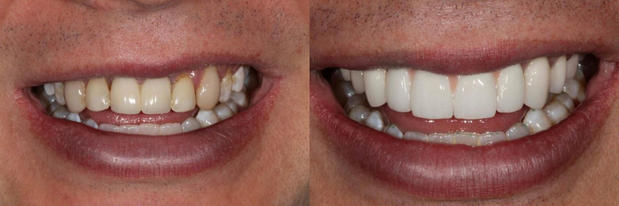 Images Precision Dental Partners
