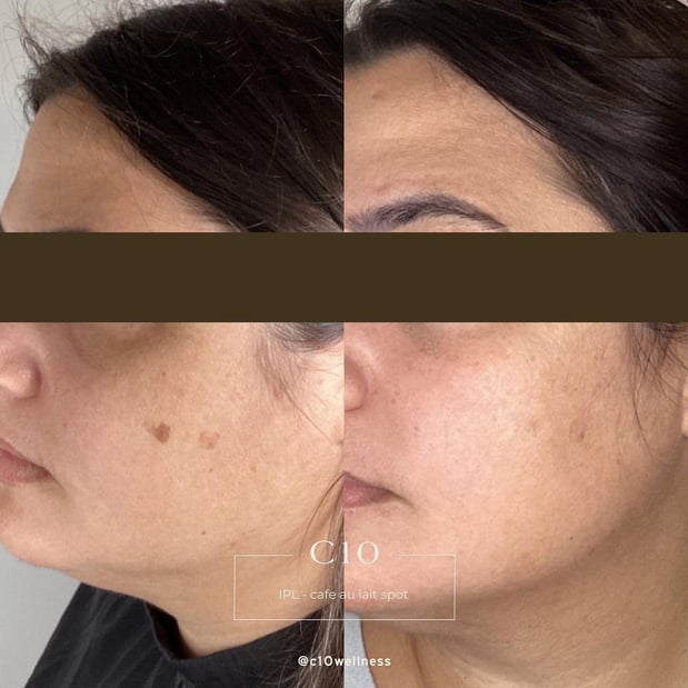 Images C10 Wellness and Rejuvenation