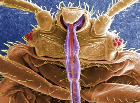Image 4 | Long Island Bedbug Inspections