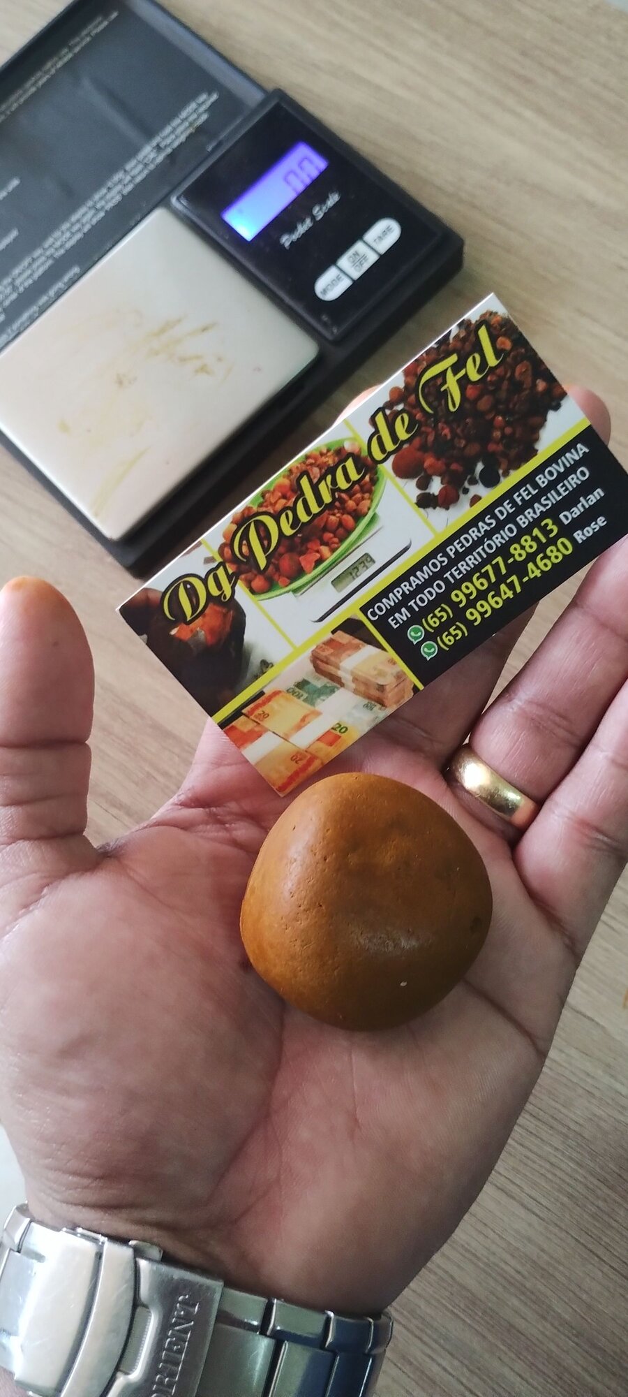 Images Dg pedras de fel bovinos