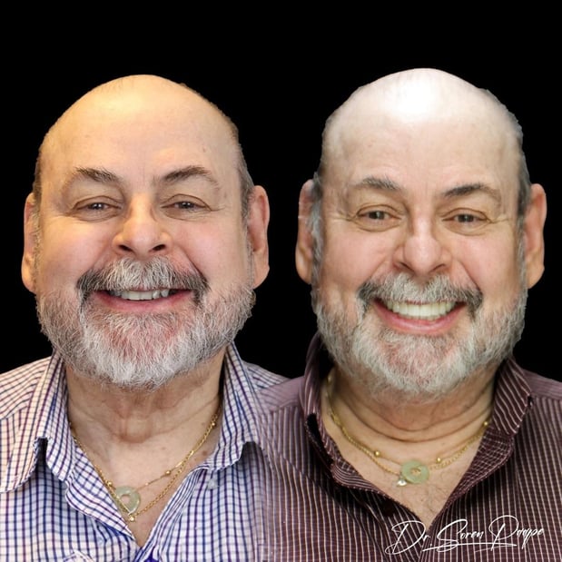 Images Smile Now Denver Dentures and Implants