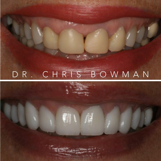 Images Advanced Dentistry of Charlotte