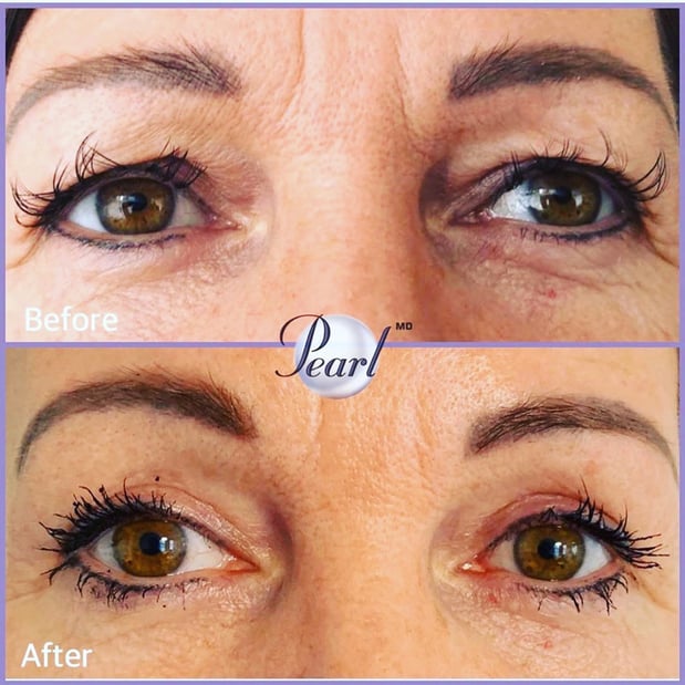 Images Renew Body Contouring & MedSpa