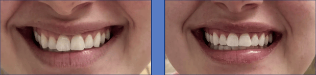 Images Preference Dental (Mecosta)