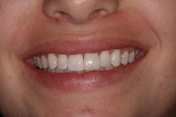 Images Aaron A. Leishman DMD, PA