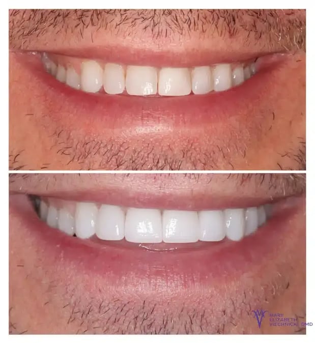 Images Mary Elizabeth Viechnicki, DMD