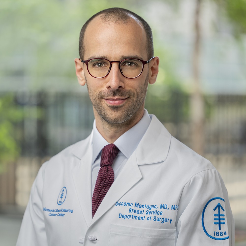 Giacomo Montagna, MD, MPH - MSK Breast Surgeon