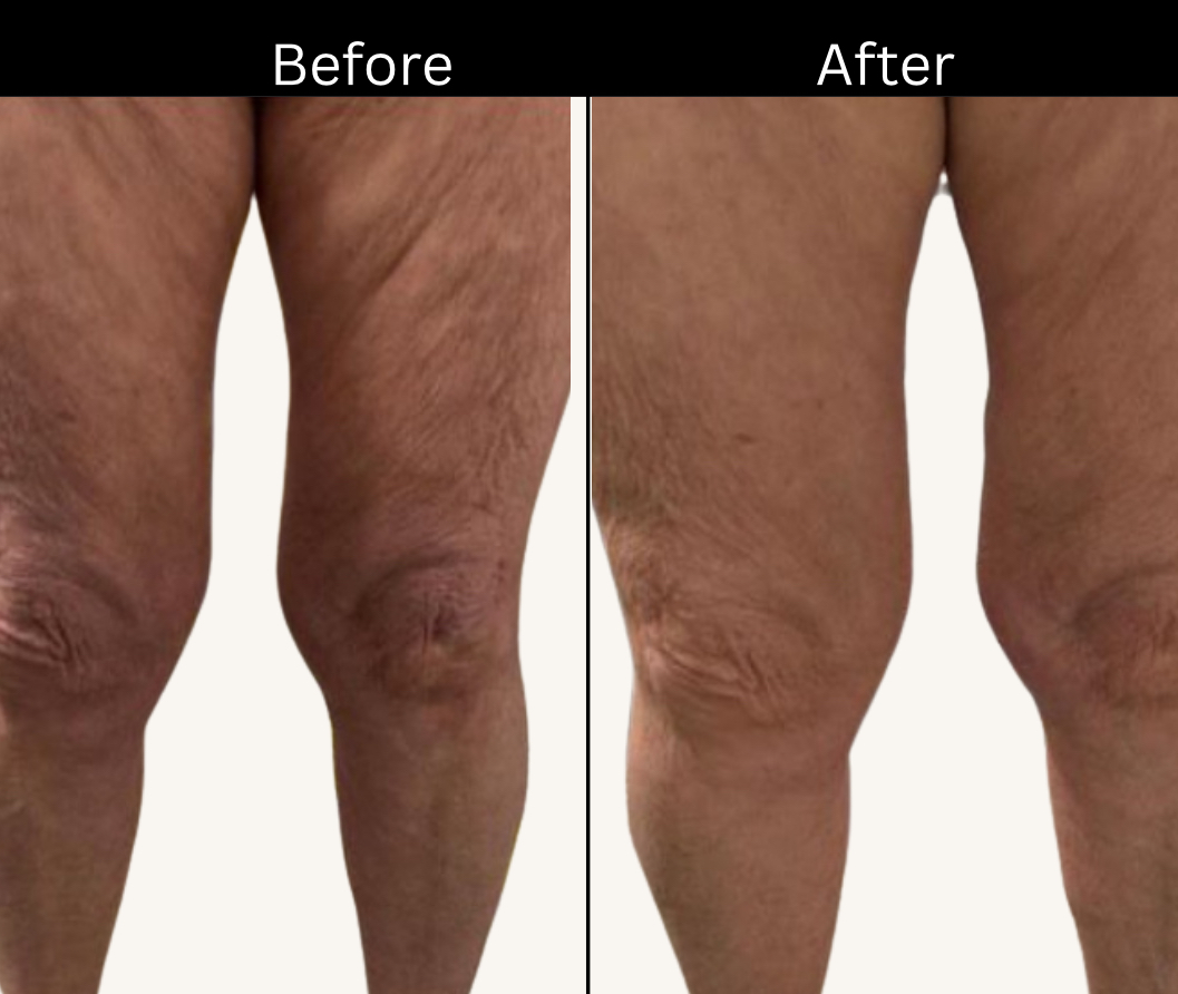 Images Onyx Esthétique - Soins esthétiques, Soins de la peau, Laser Cynosure Gatineau