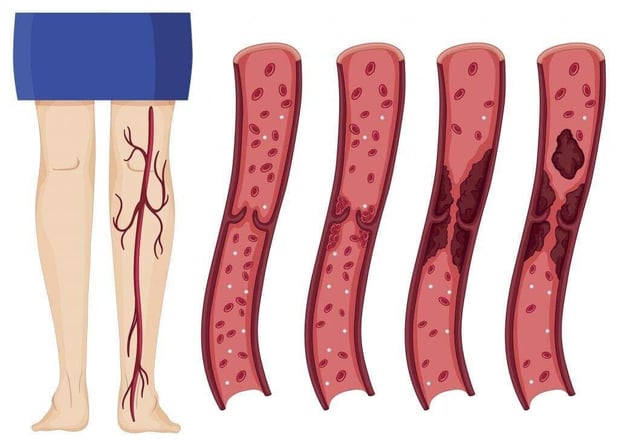 Images Physicians Vein Clinics