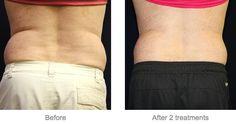 Images EvolvMD MedSpa & Body Contouring
