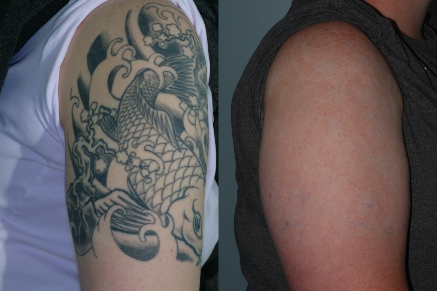 Перекрытие Татуировки черно-серой краской без лазера фото