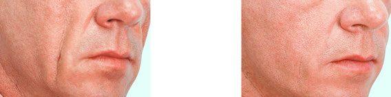 Dr. Marlene Kachelmaier - Ordination für Ästhetische Medizin, Halsweg 11 in Trofaiach