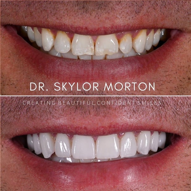 Images Nashville Wisdom Teeth and Implant Solutions